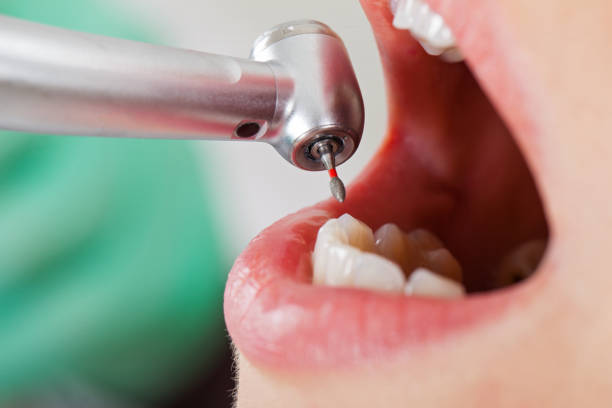 Best Emergency Treatment for Dental Infections or Abscesses in Harleysville, PA
